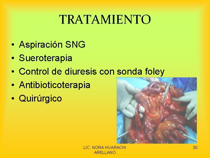 TRATAMIENTO • • • Aspiración SNG Sueroterapia Control de diuresis con sonda foley Antibioticoterapia