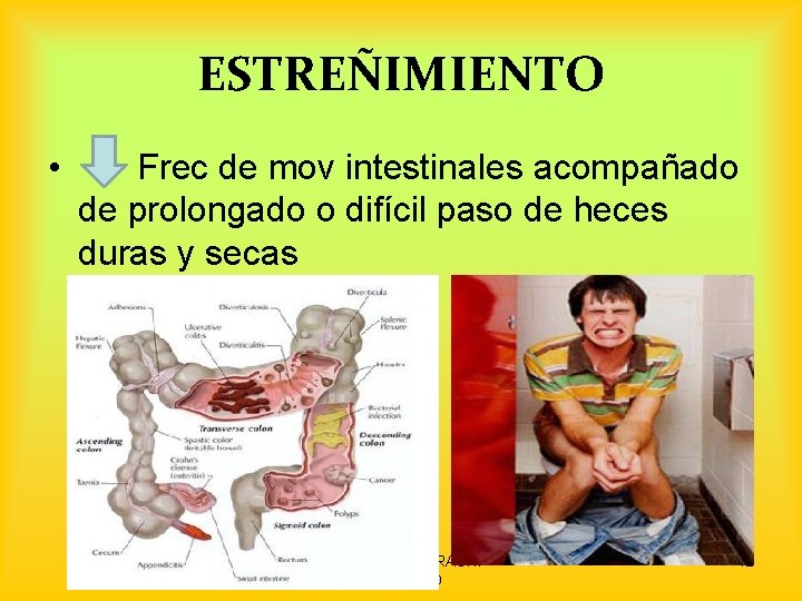 ESTREÑIMIENTO • Frec de mov intestinales acompañado de prolongado o difícil paso de heces