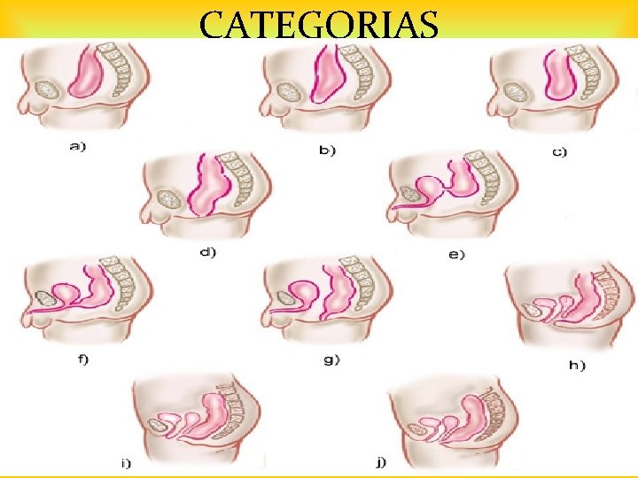 CATEGORIAS LIC. NORA HUARACHI ARELLANO 55 