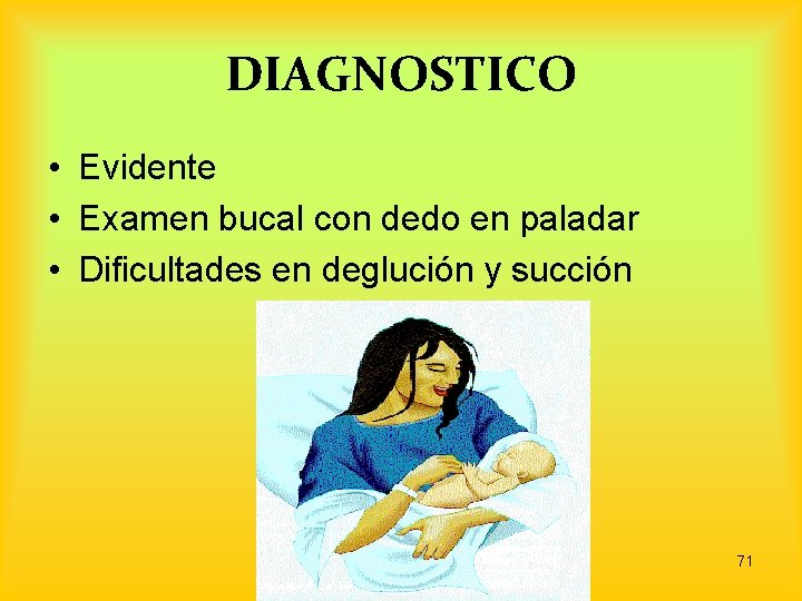 DIAGNOSTICO • Evidente • Examen bucal con dedo en paladar • Dificultades en deglución