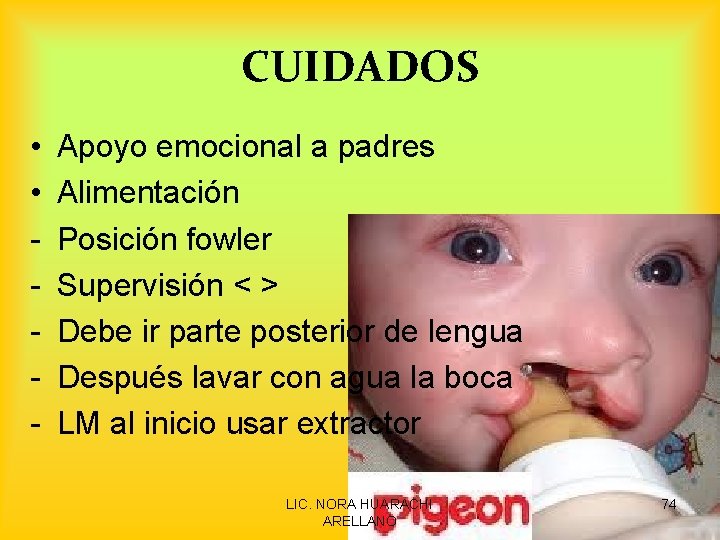 CUIDADOS • • - Apoyo emocional a padres Alimentación Posición fowler Supervisión < >