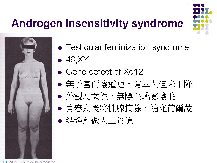 Androgen insensitivity syndrome l l l l Testicular feminization syndrome 46, XY Gene defect