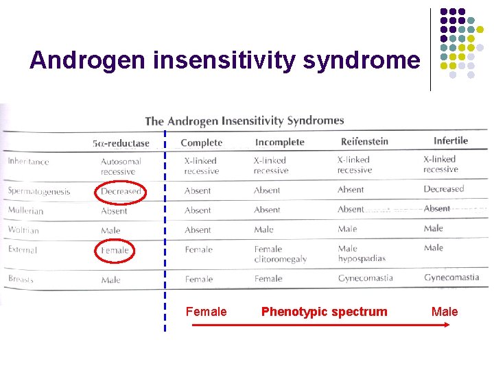 Androgen insensitivity syndrome Female Phenotypic spectrum Male 