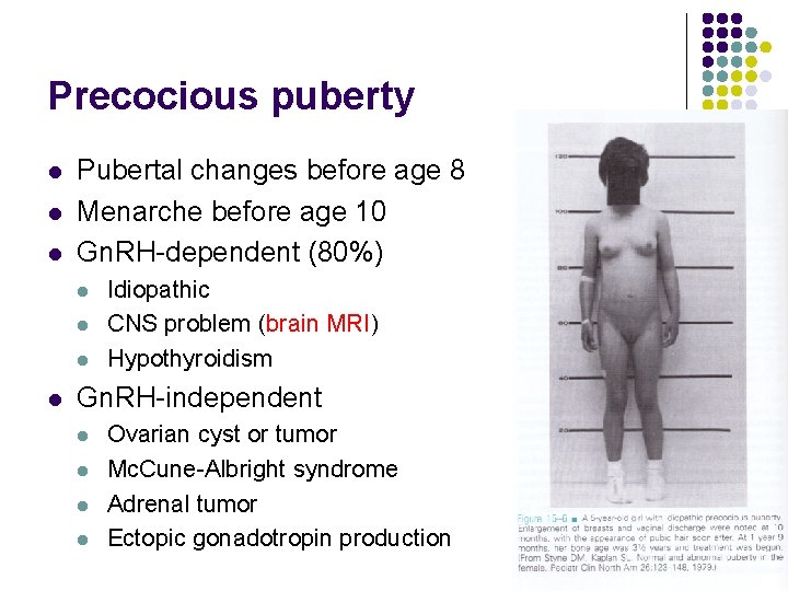 Precocious puberty l l l Pubertal changes before age 8 Menarche before age 10