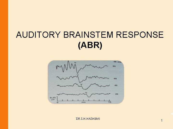 AUDITORY BRAINSTEM RESPONSE (ABR) DR. S. H. HASHEMI 1 