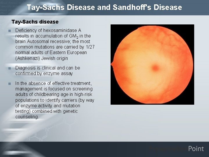 Tay-Sachs Disease and Sandhoff's Disease Tay-Sachs disease < Deficiency of hexosaminidase A results in