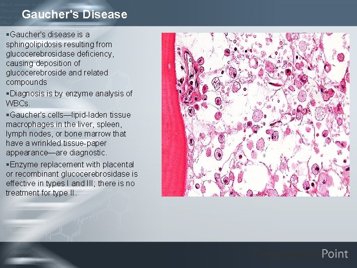 Gaucher's Disease §Gaucher's disease is a sphingolipidosis resulting from glucocerebrosidase deficiency, causing deposition of