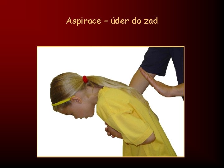 Aspirace – úder do zad 