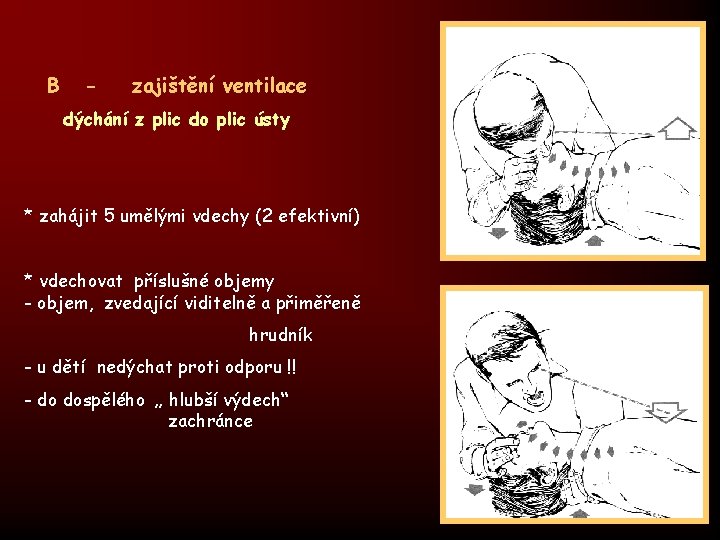 B - zajištění ventilace dýchání z plic do plic ústy * zahájit 5 umělými