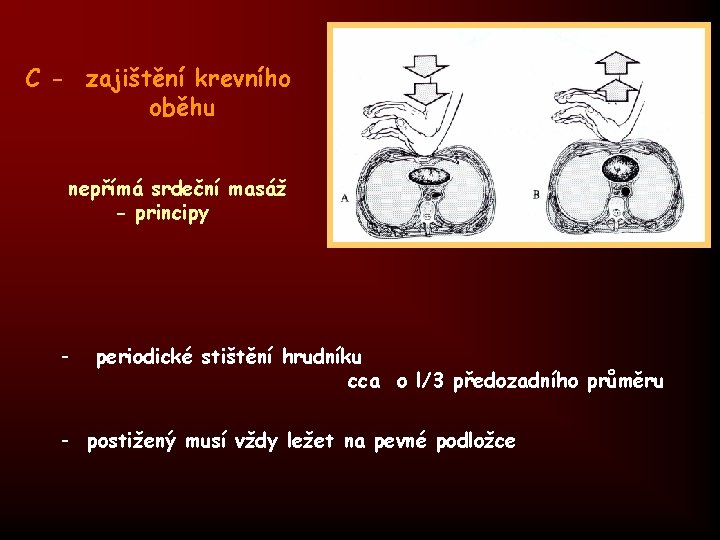 C - zajištění krevního oběhu nepřímá srdeční masáž - principy - periodické stištění hrudníku