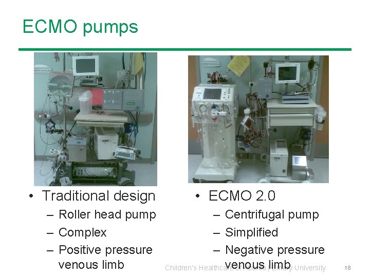 ECMO pumps • Traditional design – Roller head pump – Complex – Positive pressure ECMO pumps • Traditional design – Roller head pump – Complex – Positive pressure