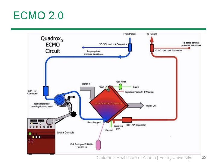 ECMO 2. 0 Children’s Healthcare of Atlanta | Emory University 20 ECMO 2. 0 Children’s Healthcare of Atlanta | Emory University 20