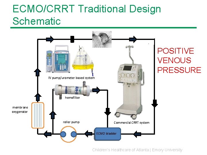 ECMO/CRRT Traditional Design Schematic POSITIVE VENOUS PRESSURE IV pump/urometer based system hemofilter membrane oxygenator ECMO/CRRT Traditional Design Schematic POSITIVE VENOUS PRESSURE IV pump/urometer based system hemofilter membrane oxygenator