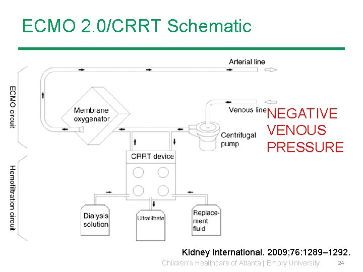 ECMO 2. 0/CRRT Schematic NEGATIVE VENOUS PRESSURE Kidney International. 2009; 76: 1289– 1292. Children’s ECMO 2. 0/CRRT Schematic NEGATIVE VENOUS PRESSURE Kidney International. 2009; 76: 1289– 1292. Children’s