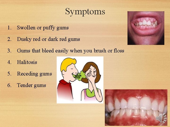 Symptoms 1. Swollen or puffy gums 2. Dusky red or dark red gums 3. Symptoms 1. Swollen or puffy gums 2. Dusky red or dark red gums 3.