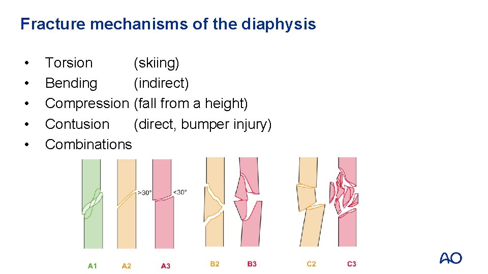 Fracture mechanisms of the diaphysis • • • Torsion (skiing) Bending (indirect) Compression (fall