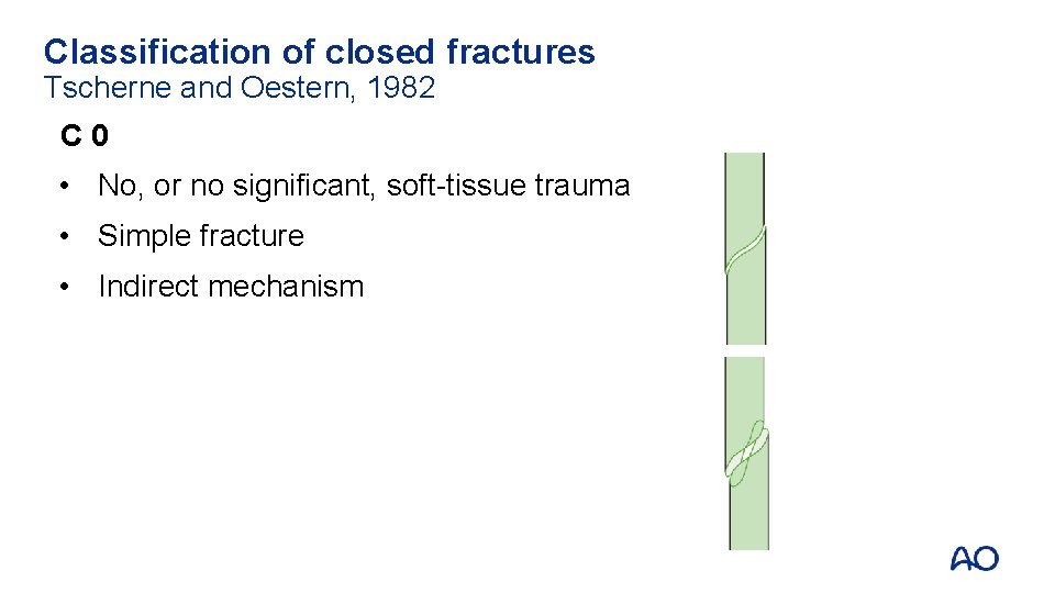 Classification of closed fractures Tscherne and Oestern, 1982 C 0 • No, or no