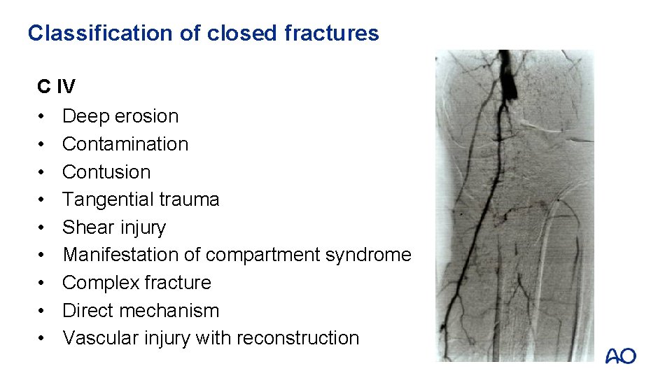 Classification of closed fractures C IV • • • Deep erosion Contamination Contusion Tangential