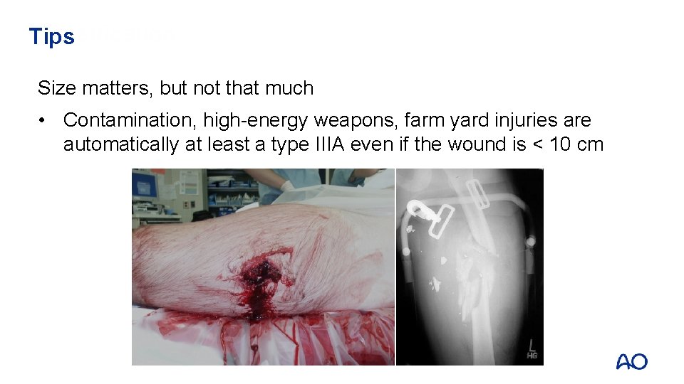 Classification Tips Size matters, but not that much • Contamination, high-energy weapons, farm yard