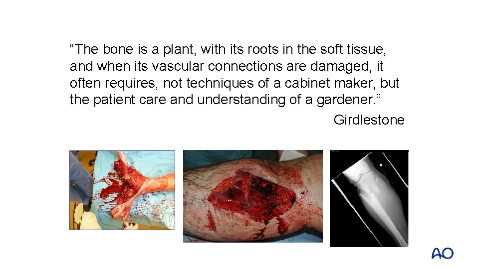“The bone is a plant, with its roots in the soft tissue, and when