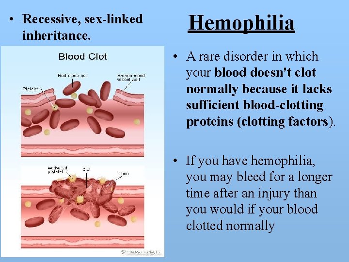  • Recessive, sex-linked inheritance. Hemophilia • A rare disorder in which your blood