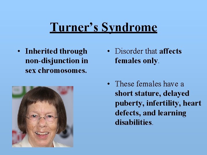 Turner’s Syndrome • Inherited through non-disjunction in sex chromosomes. • Disorder that affects females