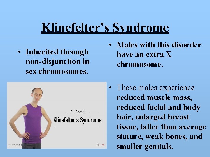 Klinefelter’s Syndrome • Inherited through non-disjunction in sex chromosomes. • Males with this disorder