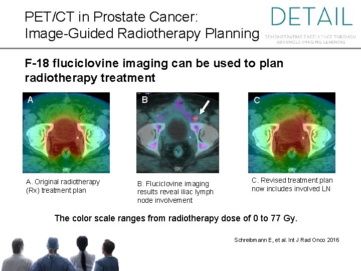 PET/CT in Prostate Cancer: Image-Guided Radiotherapy Planning F-18 fluciclovine imaging can be used to
