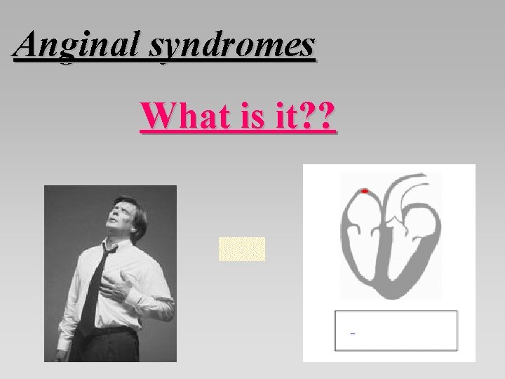 Anginal syndromes What is it? ? 