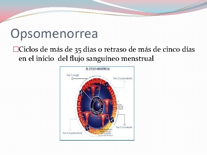 Opsomenorrea �Ciclos de más de 35 días o retraso de más de cinco días Opsomenorrea �Ciclos de más de 35 días o retraso de más de cinco días