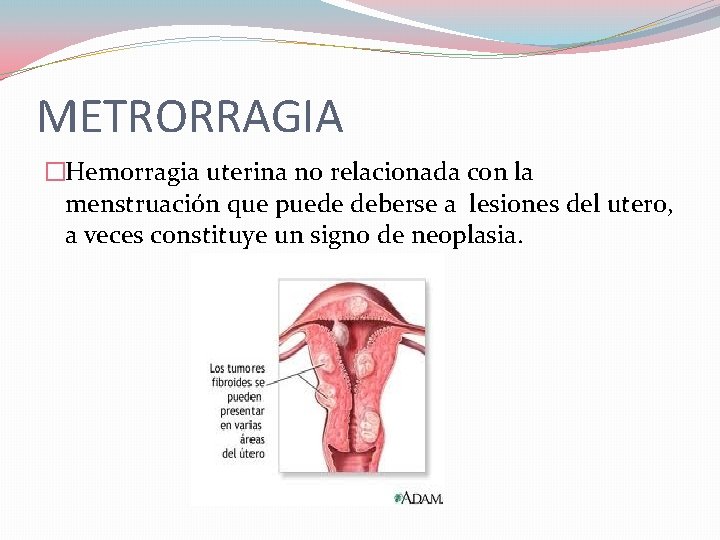 METRORRAGIA �Hemorragia uterina no relacionada con la menstruación que puede deberse a lesiones del METRORRAGIA �Hemorragia uterina no relacionada con la menstruación que puede deberse a lesiones del