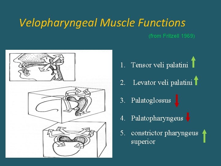 Velopharyngeal Muscle Functions (from Fritzell 1969) 1. Tensor veli palatini 2. Levator veli palatini
