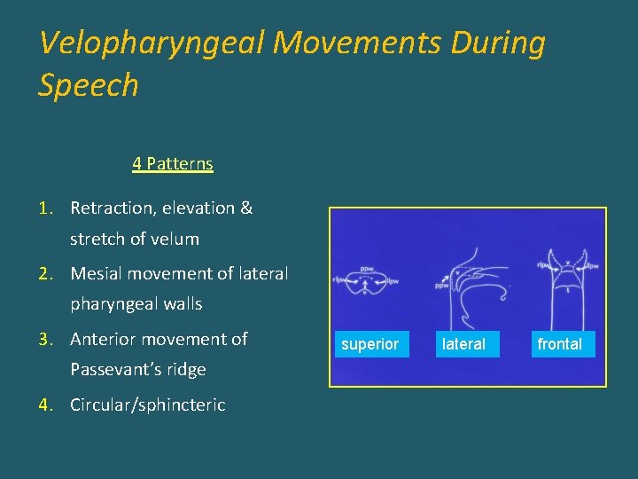 Velopharyngeal Movements During Speech 4 Patterns 1. Retraction, elevation & stretch of velum 2.