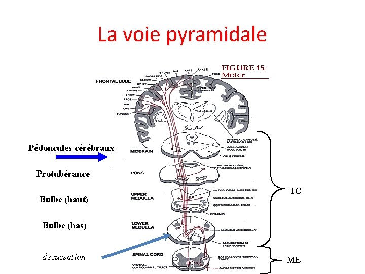 La voie pyramidale Pédoncules cérébraux Protubérance Bulbe (haut) TC Bulbe (bas) décussation ME 