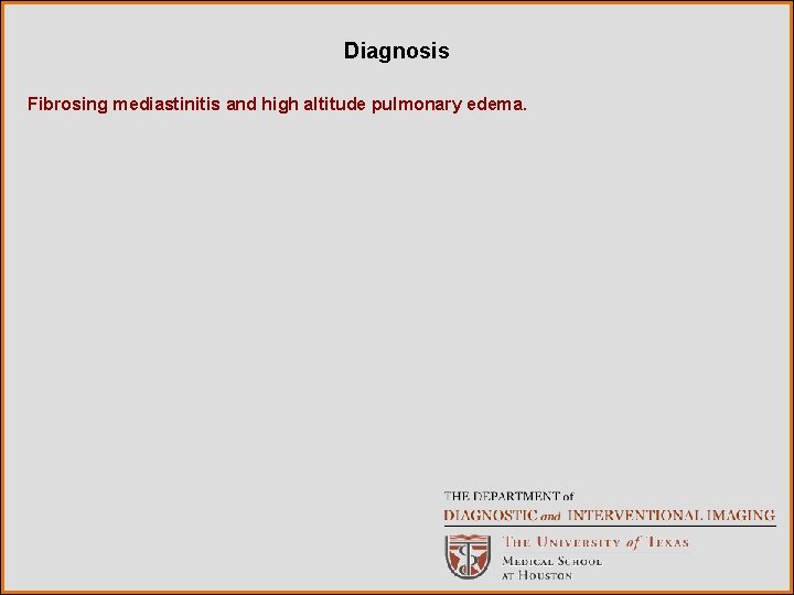 Diagnosis Fibrosing mediastinitis and high altitude pulmonary edema. 