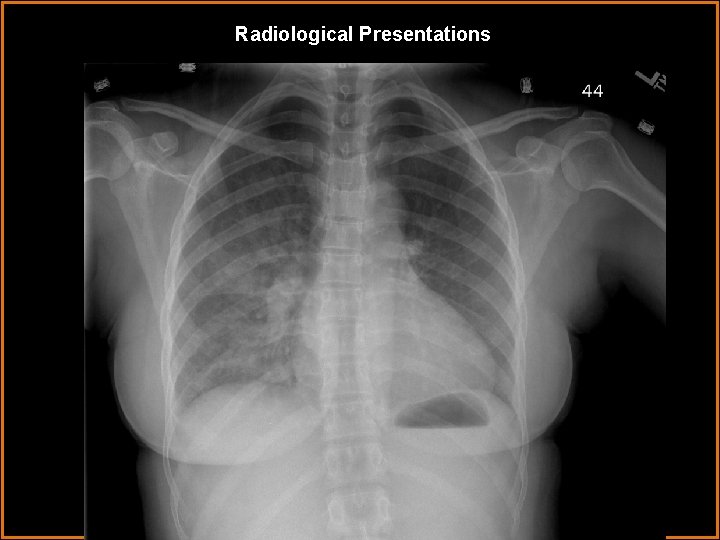 Radiological Presentations 