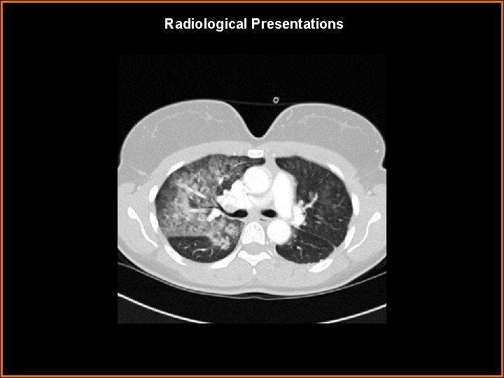 Radiological Presentations 