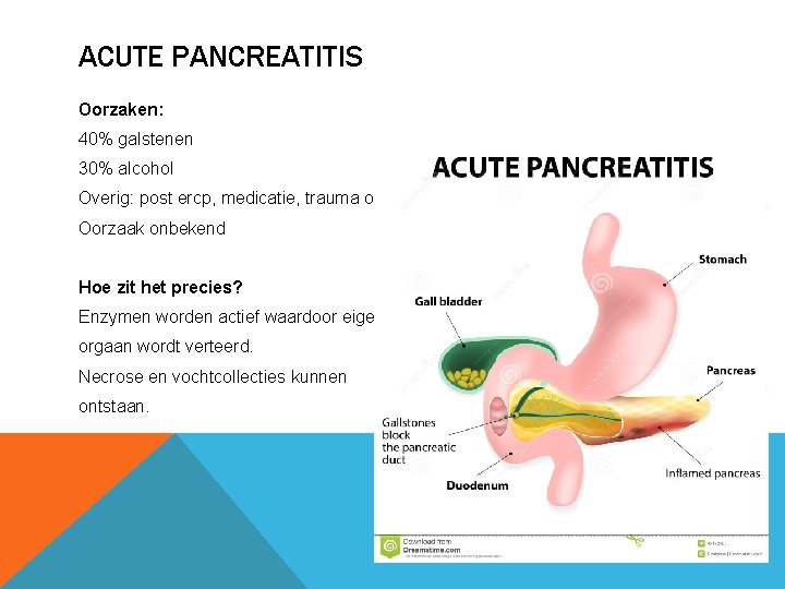 ACUTE PANCREATITIS Oorzaken: 40% galstenen 30% alcohol Overig: post ercp, medicatie, trauma of Oorzaak