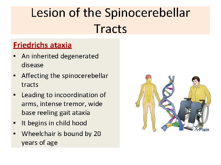 Lesion of the Spinocerebellar Tracts Friedrichs ataxia • An inherited degenerated disease • Affecting