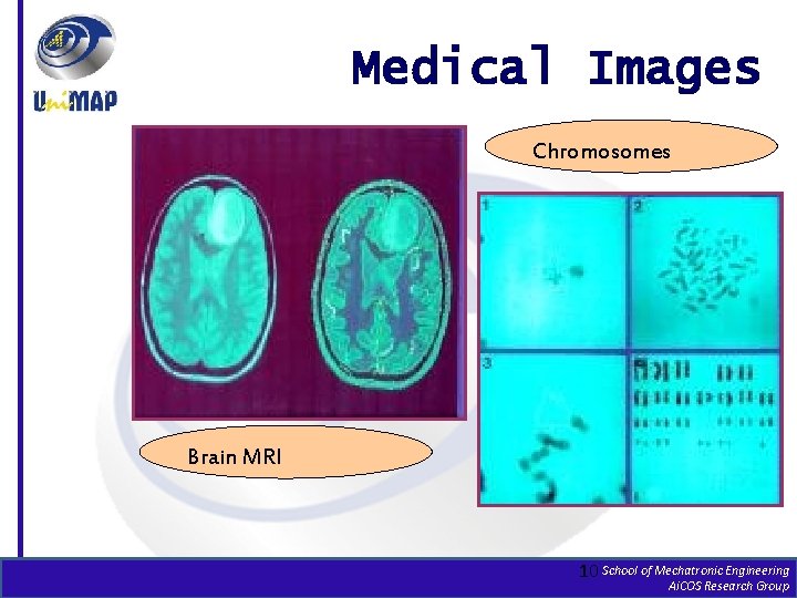 Medical Images Chromosomes Brain MRI 10 School of Mechatronic Engineering Ai. COS Research Group