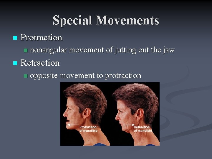 Special Movements n Protraction n n nonangular movement of jutting out the jaw Retraction