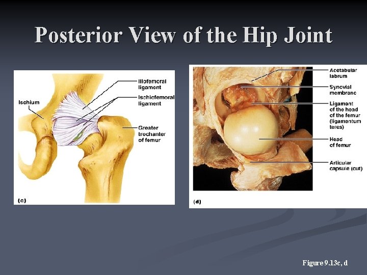 Posterior View of the Hip Joint Figure 9. 13 c, d 