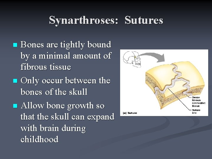Synarthroses: Sutures Bones are tightly bound by a minimal amount of fibrous tissue n