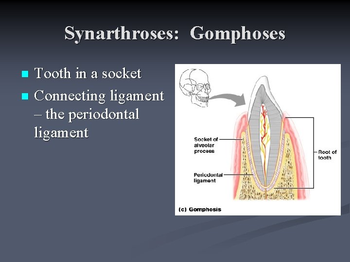 Synarthroses: Gomphoses Tooth in a socket n Connecting ligament – the periodontal ligament n