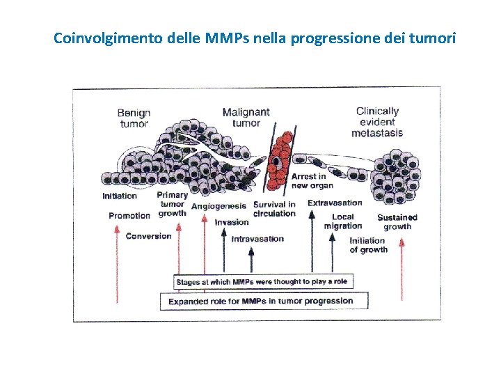 Coinvolgimento delle MMPs nella progressione dei tumori 