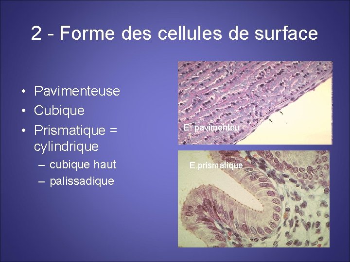 2 - Forme des cellules de surface • Pavimenteuse • Cubique • Prismatique =
