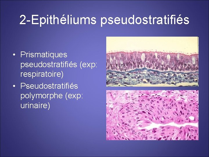 2 -Epithéliums pseudostratifiés • Prismatiques pseudostratifiés (exp: respiratoire) • Pseudostratifiés polymorphe (exp: urinaire) 