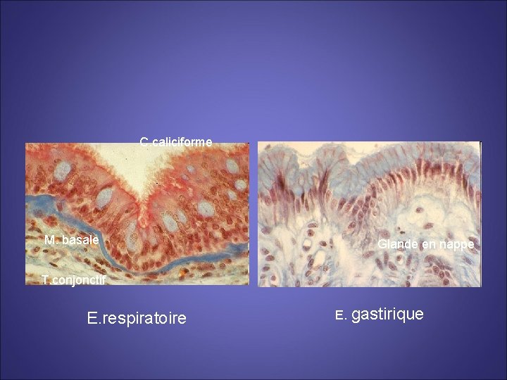 C. caliciforme M. basale Glande en nappe T. conjonctif E. respiratoire E. gastirique 