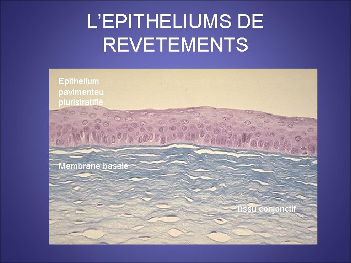 L’EPITHELIUMS DE REVETEMENTS Epithelium pavimenteu pluristratifié Membrane basale Tissu conjonctif 