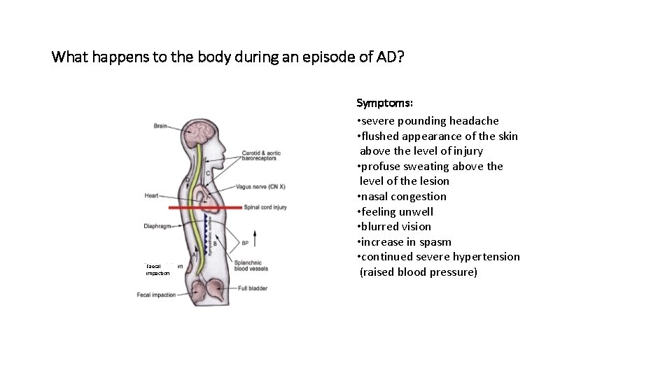 What happens to the body during an episode of AD? Faecal impaction Symptoms: •